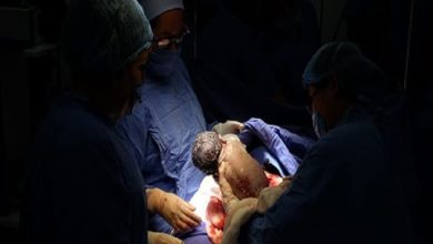 Es niña y se llama Aylin. Foto: IMSS.